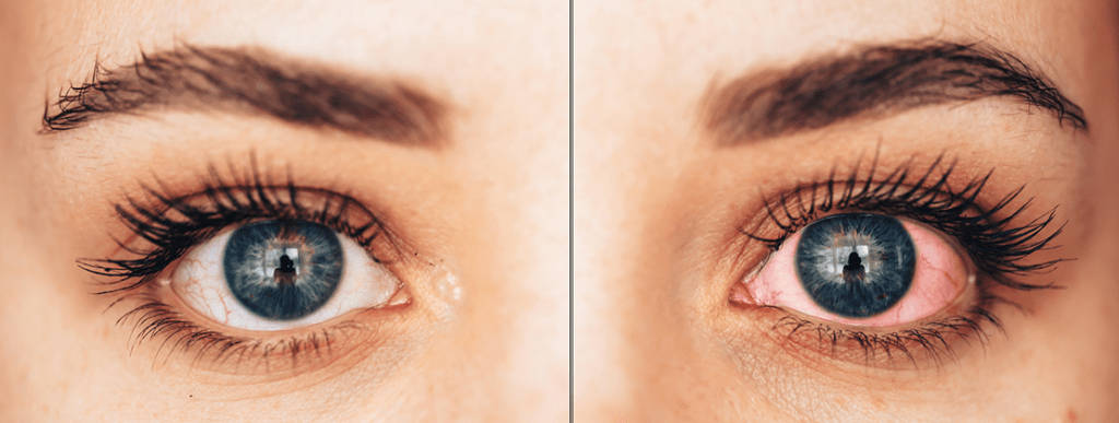 Occhi sani e luminosi: 5 abitudini quotidiane che fanno la differenza - demo1.iopromoweb.net